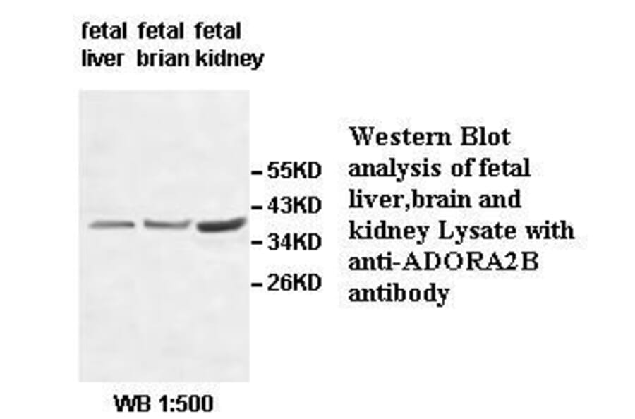 ADORA2B Antibody from Signalway Antibody (39513) - Antibodies.com