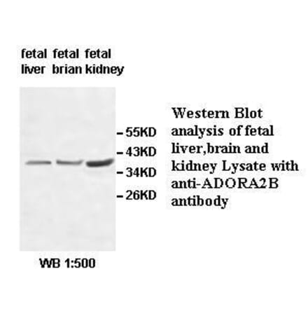 ADORA2B Antibody from Signalway Antibody (39513) - Antibodies.com