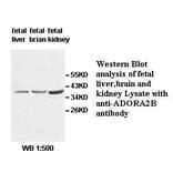ADORA2B Antibody from Signalway Antibody (39513) - Antibodies.com