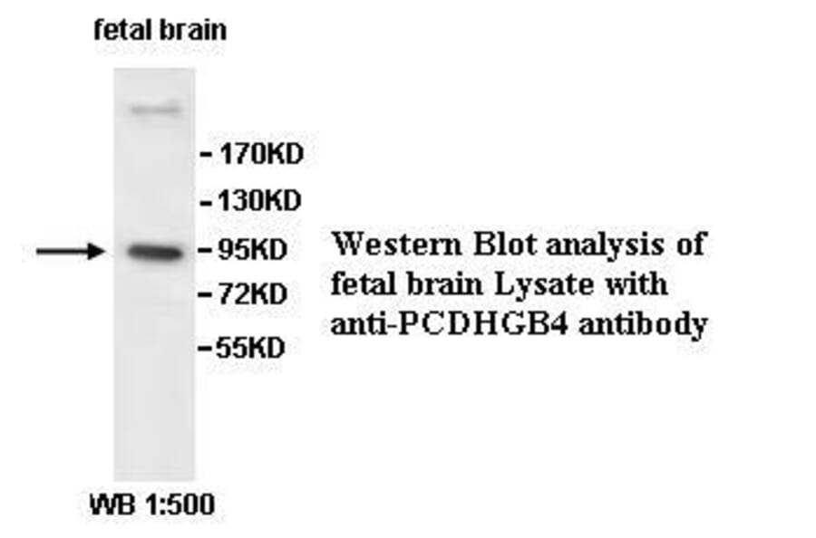 PCDHGB4 Antibody from Signalway Antibody (39530) - Antibodies.com