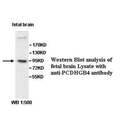 PCDHGB4 Antibody from Signalway Antibody (39530) - Antibodies.com