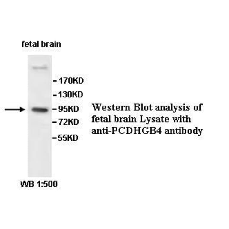 PCDHGB4 Antibody from Signalway Antibody (39530) - Antibodies.com
