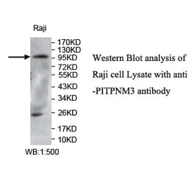 PITPNM3 Antibody from Signalway Antibody (39735) - Antibodies.com