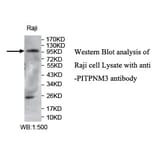 PITPNM3 Antibody from Signalway Antibody (39735) - Antibodies.com