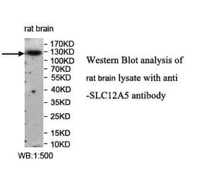 SLC12A5 Antibody from Signalway Antibody (39959) - Antibodies.com