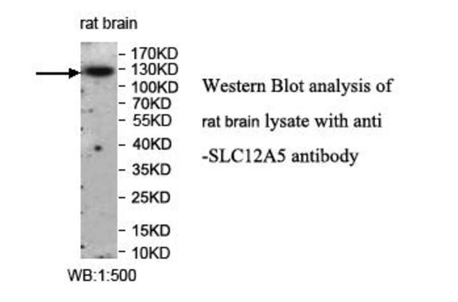 SLC12A5 Antibody from Signalway Antibody (39959) - Antibodies.com