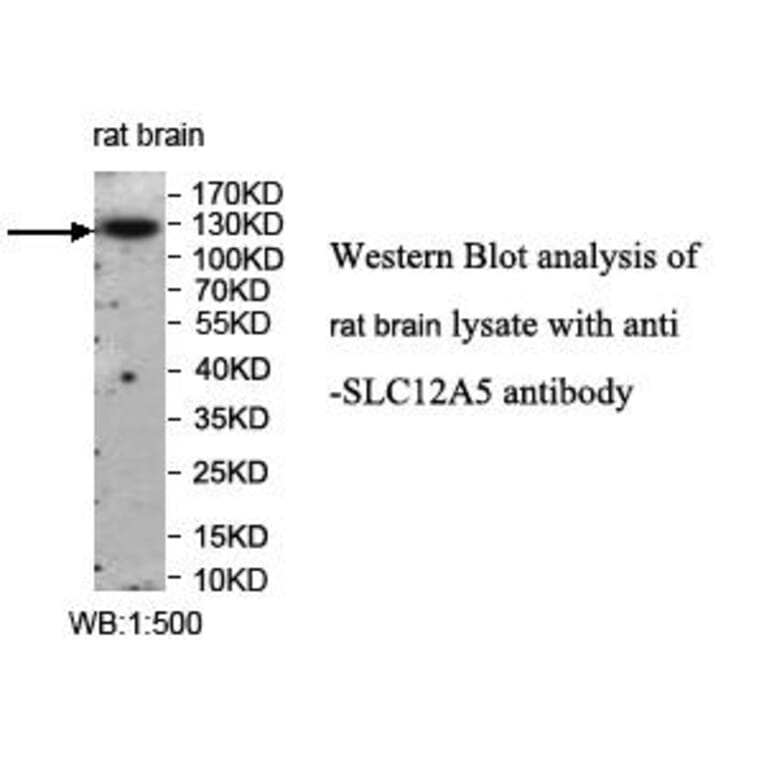 SLC12A5 Antibody from Signalway Antibody (39959) - Antibodies.com
