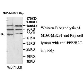 PPP2R2C Antibody from Signalway Antibody (39986) - Antibodies.com