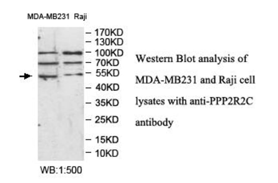 PPP2R2C Antibody from Signalway Antibody (39986) - Antibodies.com