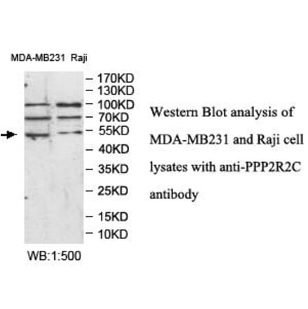 PPP2R2C Antibody from Signalway Antibody (39986) - Antibodies.com