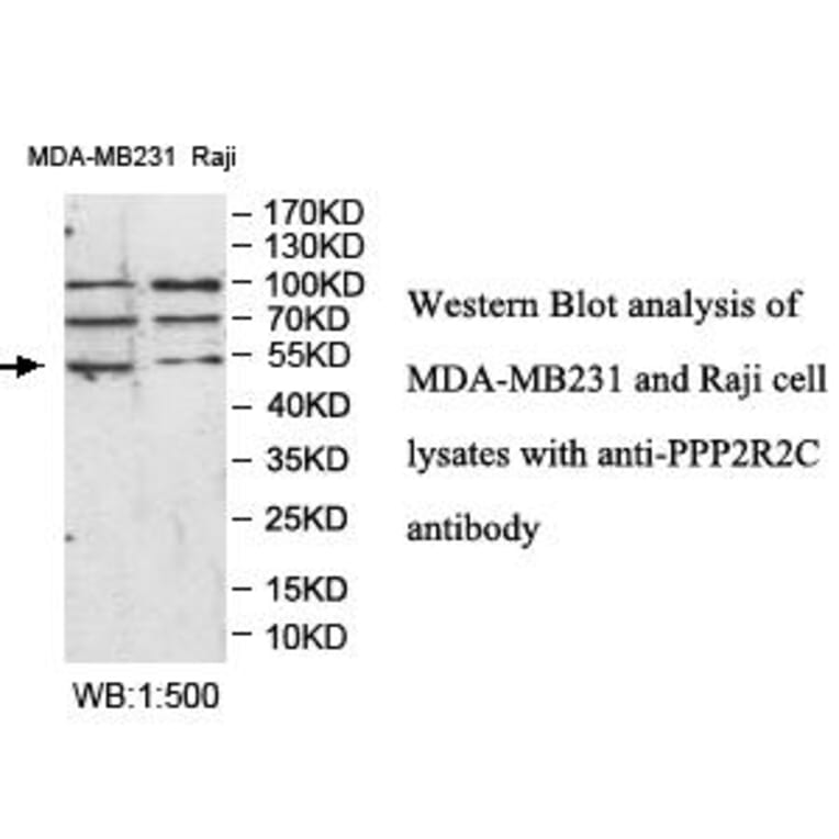 PPP2R2C Antibody from Signalway Antibody (39986) - Antibodies.com