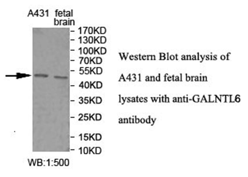 Anti-GALNTL6 Antibody