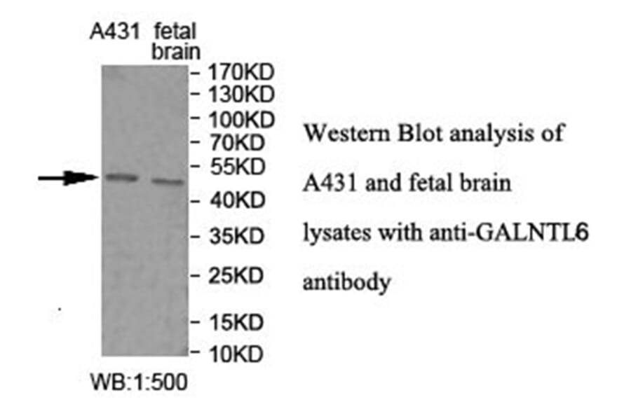 GALNTL6 Antibody from Signalway Antibody (40025) - Antibodies.com