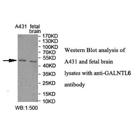 GALNTL6 Antibody from Signalway Antibody (40025) - Antibodies.com