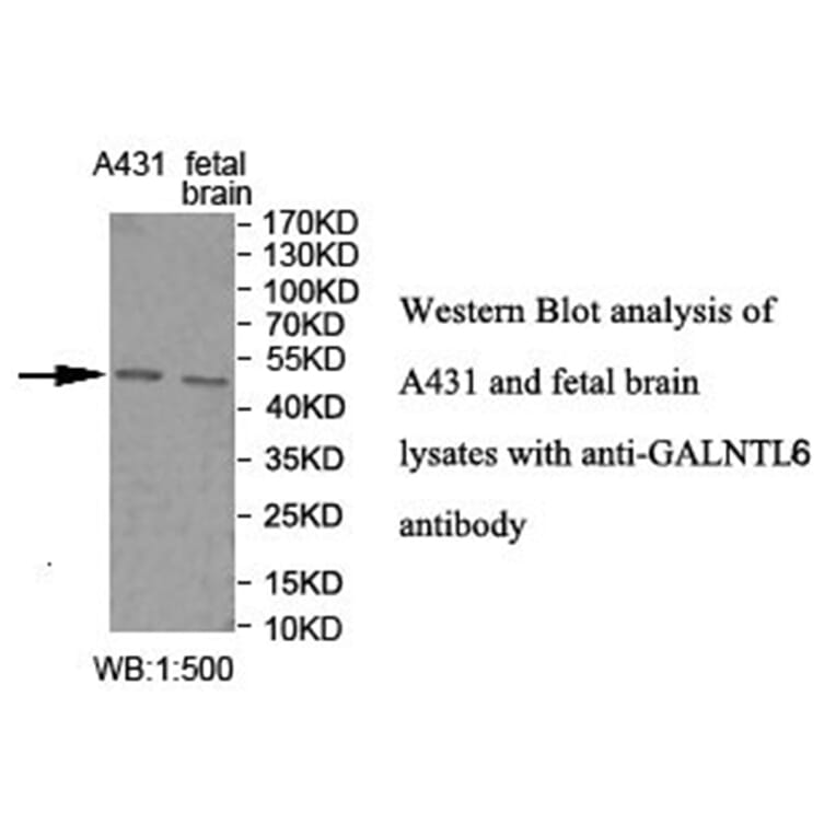 GALNTL6 Antibody from Signalway Antibody (40025) - Antibodies.com