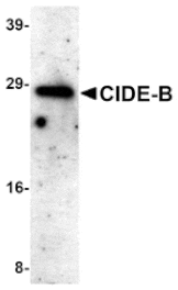 Western blot - CIDE-B Antibody from Signalway Antibody (24055) - Antibodies.com