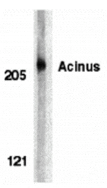 Western blot - Acinus Antibody from Signalway Antibody (24096) - Antibodies.com