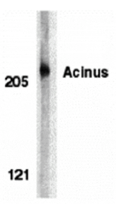 Western blot - Acinus Antibody from Signalway Antibody (24096) - Antibodies.com