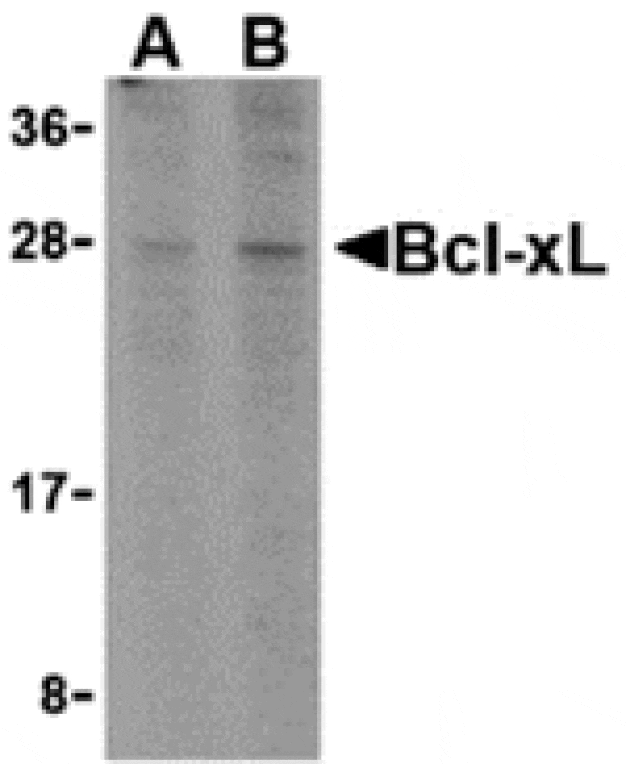 Western blot - Bcl-xL Antibody from Signalway Antibody (24247) - Antibodies.com