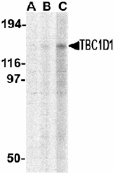 Western blot - TBC1D1 Antibody from Signalway Antibody (24536) - Antibodies.com