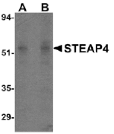 Western blot - STEAP4 Antibody from Signalway Antibody (24569) - Antibodies.com