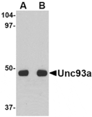 Western blot - Unc93a Antibody from Signalway Antibody (24664) - Antibodies.com