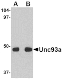 Western blot - Unc93a Antibody from Signalway Antibody (24664) - Antibodies.com