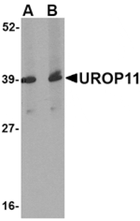 Western blot - UROP11 Antibody from Signalway Antibody (24688) - Antibodies.com