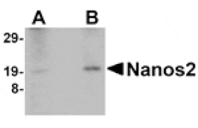 Western blot - Nanos2 Antibody from Signalway Antibody (24701) - Antibodies.com