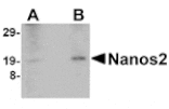 Western blot - Nanos2 Antibody from Signalway Antibody (24701) - Antibodies.com