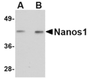 Western blot - Nanos1 Antibody from Signalway Antibody (24715) - Antibodies.com
