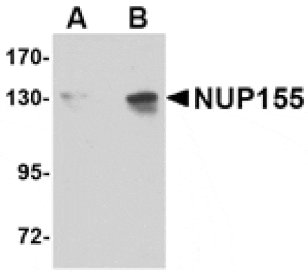 Western blot - NUP155 Antibody from Signalway Antibody (24722) - Antibodies.com