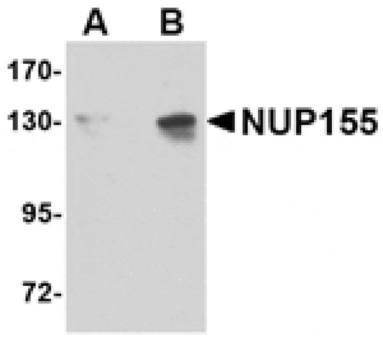 Western blot - NUP155 Antibody from Signalway Antibody (24722) - Antibodies.com