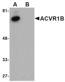 Western blot - ACVR1B Antibody from Signalway Antibody (24752) - Antibodies.com
