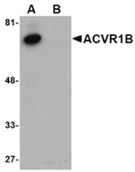 Western blot - ACVR1B Antibody from Signalway Antibody (24752) - Antibodies.com