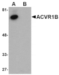 Western blot - ACVR1B Antibody from Signalway Antibody (24752) - Antibodies.com