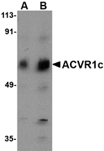 Western blot analysis of ACVR1C in human placenta tissue lysate with ACVR1C antibody at (A) 1 and (B) 2 µg/mL.