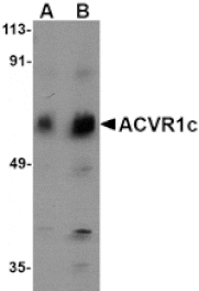 Western blot - ACVR1C Antibody from Signalway Antibody (24753) - Antibodies.com