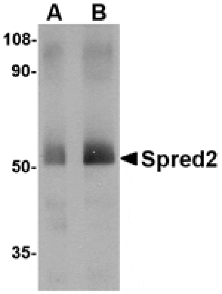 Western blot - Spred2 Antibody from Signalway Antibody (24774) - Antibodies.com