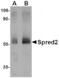 Western blot - Spred2 Antibody from Signalway Antibody (24774) - Antibodies.com