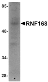 Western blot - RNF168 Antibody from Signalway Antibody (24885) - Antibodies.com