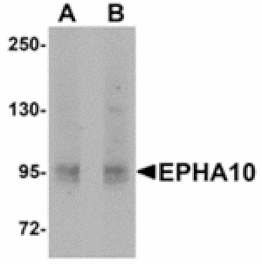 Western blot - EphA10 Antibody from Signalway Antibody (24927) - Antibodies.com