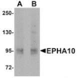 Western blot - EphA10 Antibody from Signalway Antibody (24927) - Antibodies.com