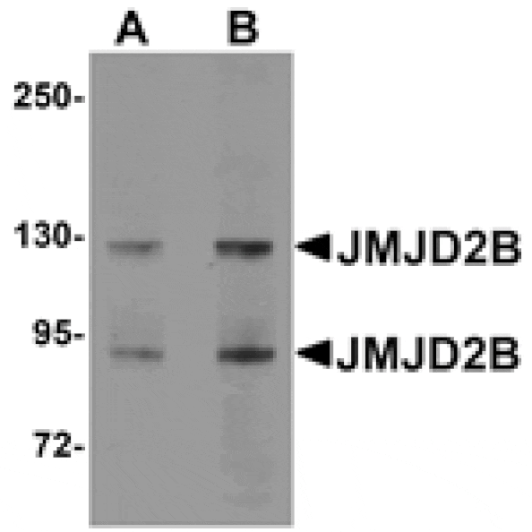Western blot - JMJD2B Antibody from Signalway Antibody (24959) - Antibodies.com