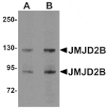 Western blot - JMJD2B Antibody from Signalway Antibody (24959) - Antibodies.com