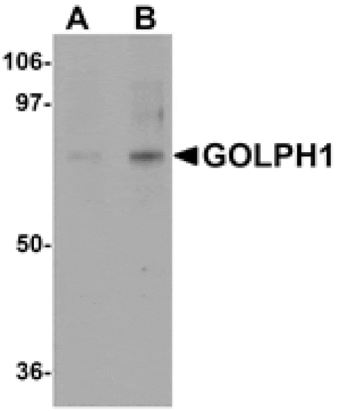 Western blot - GOLPH1 Antibody from Signalway Antibody (24984) - Antibodies.com