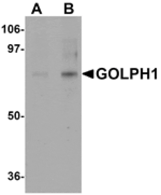 Western blot - GOLPH1 Antibody from Signalway Antibody (24984) - Antibodies.com