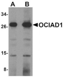 Western blot - OCIAD1 Antibody from Signalway Antibody (24995) - Antibodies.com
