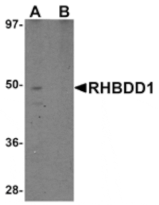 Western blot - RHBDD1 Antibody from Signalway Antibody (25020) - Antibodies.com