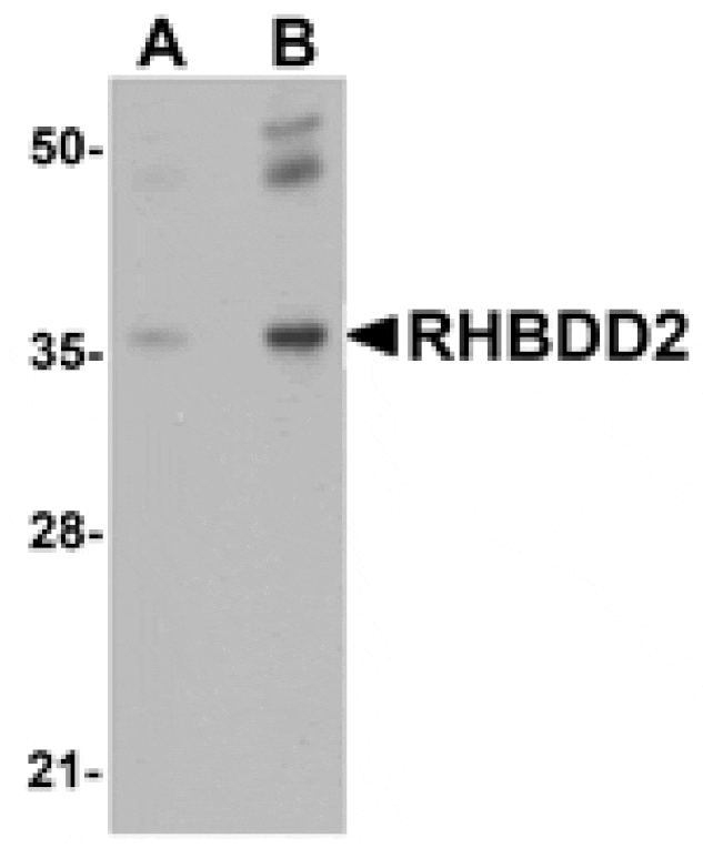 Western blot - RHBDD2 Antibody from Signalway Antibody (25021) - Antibodies.com